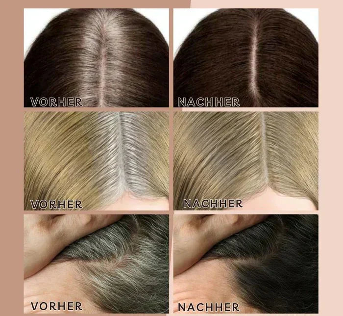 HairHalo – Effortless Hairline Perfection Anytime, Anywhere