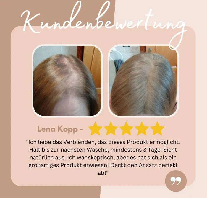 HairHalo – Effortless Hairline Perfection Anytime, Anywhere