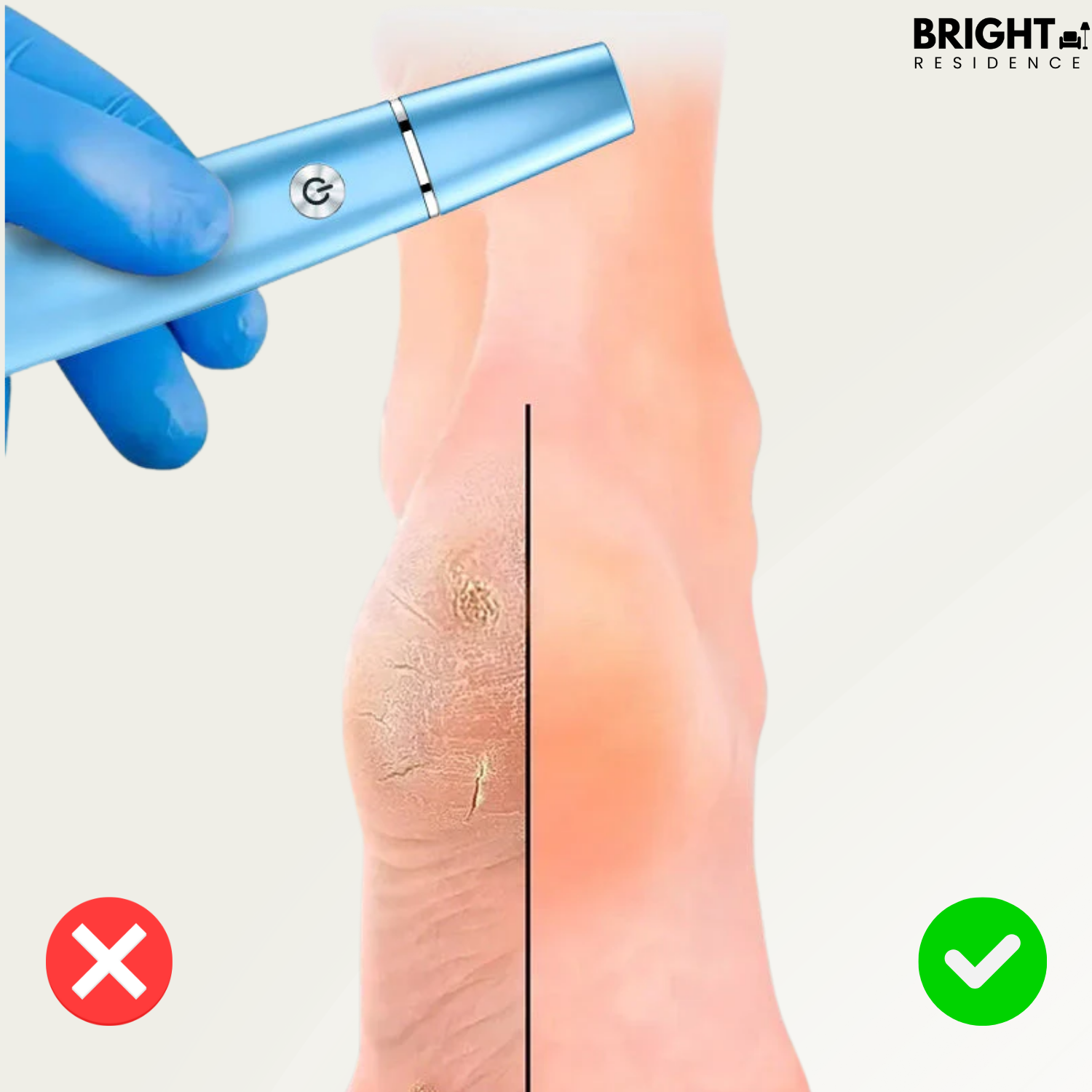 SilkaFeet™ - Effortlessly smooth and well-groomed feet
