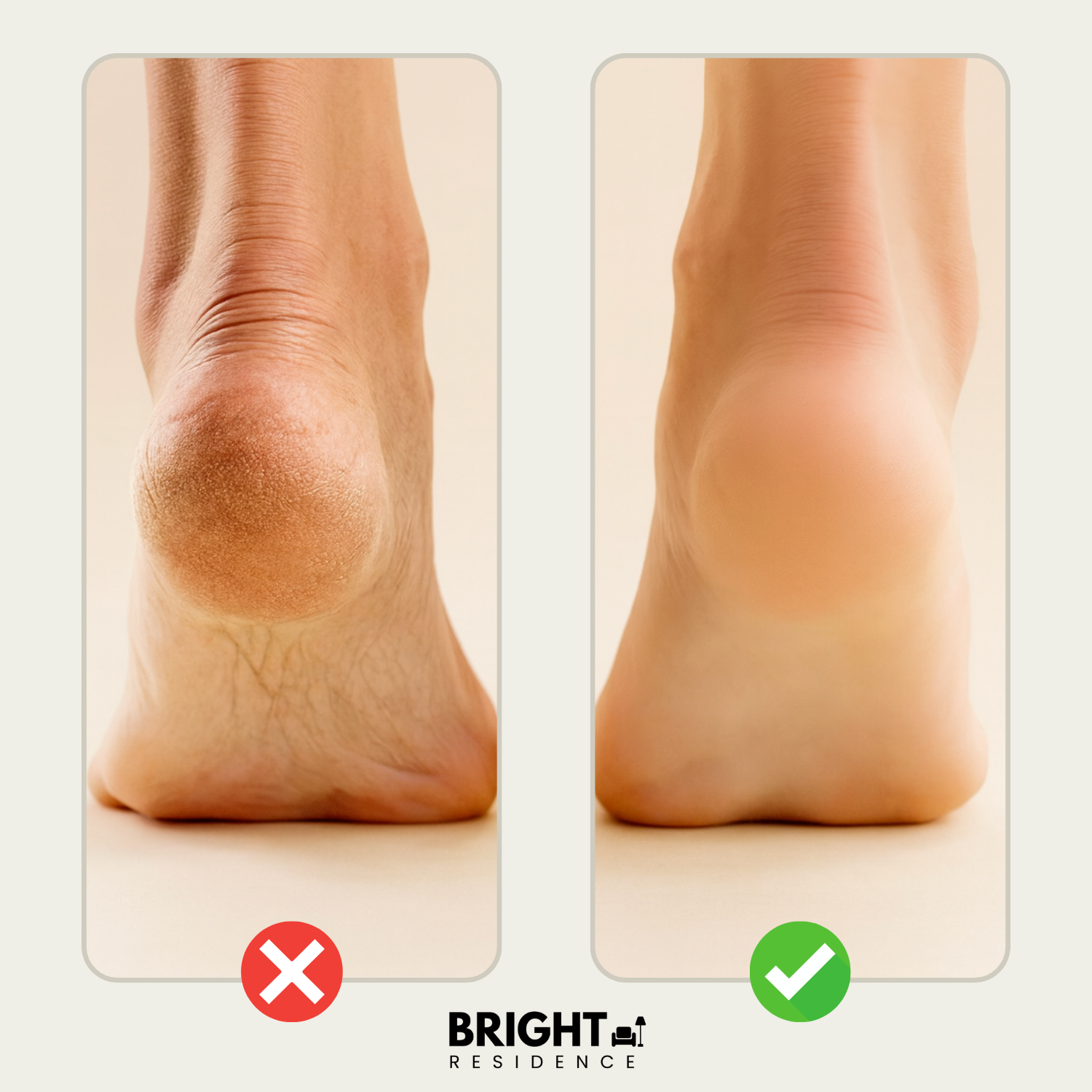 SmoothEase – The Ultimate Solution for Soft, Beautiful Feet!