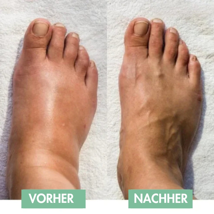 RelaxaPad – The Ultimate Solution for Foot Pain Relief