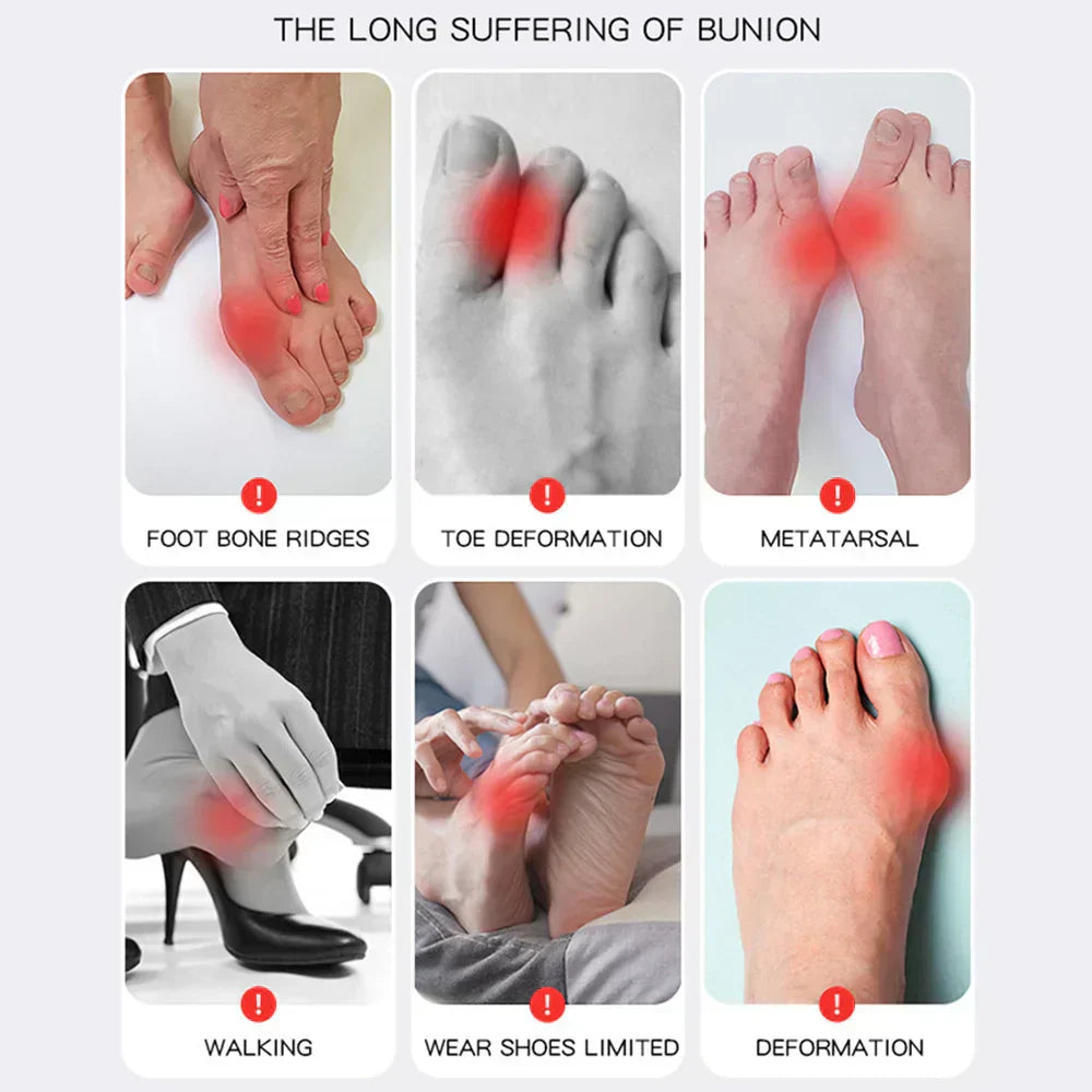 OrthoFlex – Pain-Free Steps for Hallux Valgus!