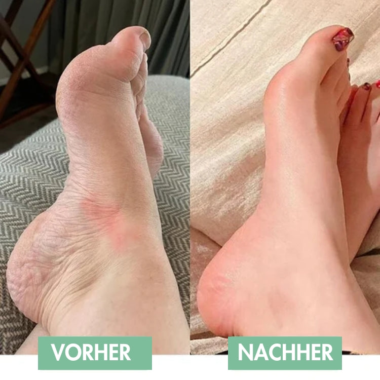 RelaxaPad – The Ultimate Solution for Foot Pain Relief