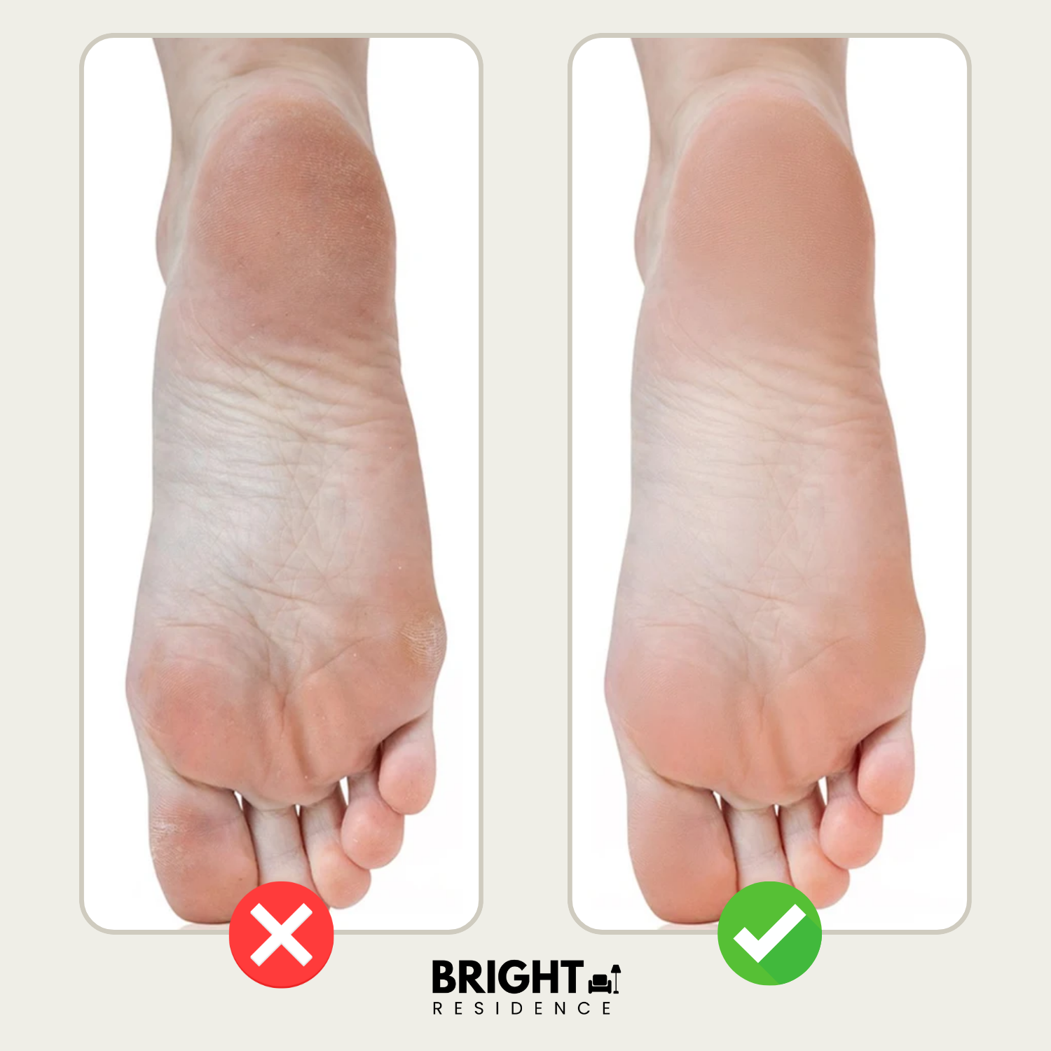 FootSmooth – Silky soft feet in just minutes!