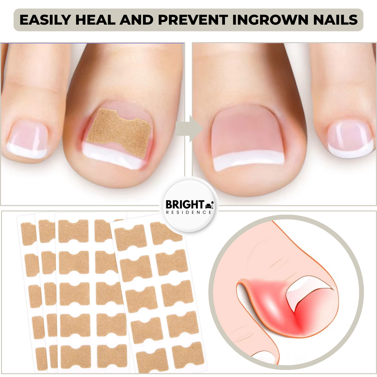 FixaNail™ - Correction Patches for Beautiful and Healthy Nails
