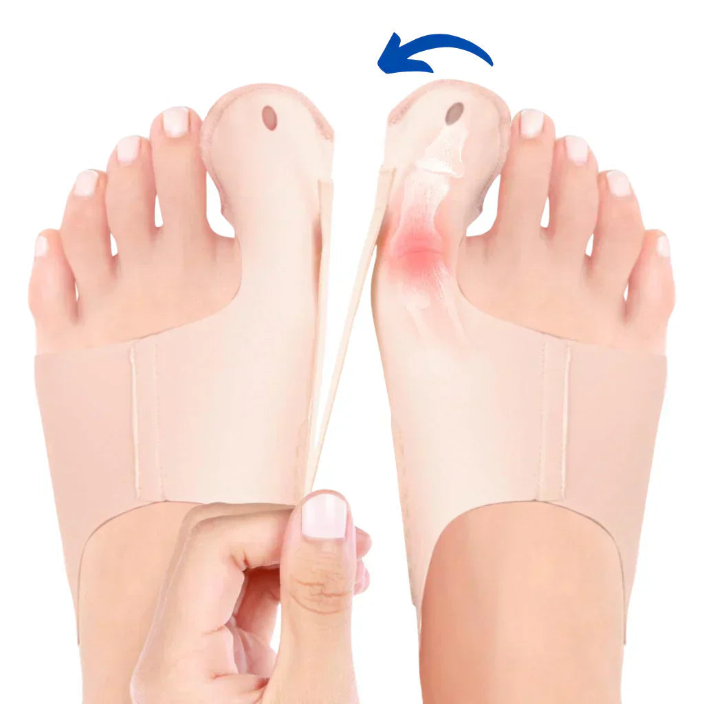 OrthoFlex – Pain-Free Steps for Hallux Valgus!