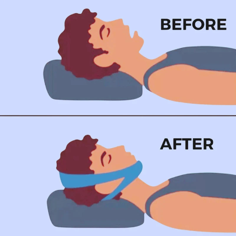 SilentFit – The Ultimate Chin Strap for Peaceful Sleep