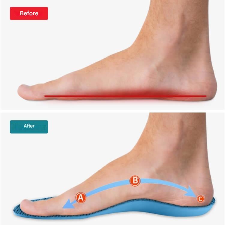 SoleCure – Ultimate Foot Relief for All-Day Comfort