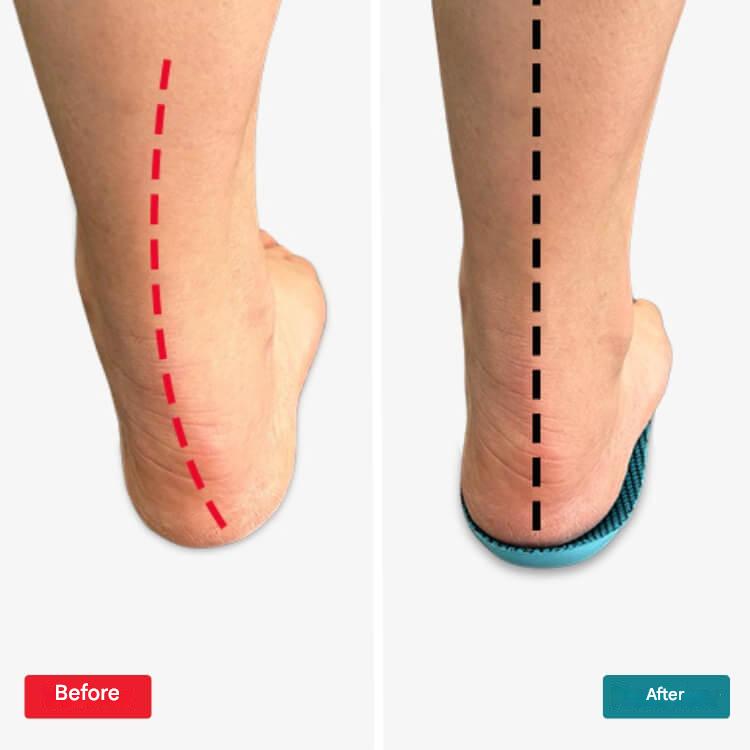SoleCure – Ultimate Foot Relief for All-Day Comfort