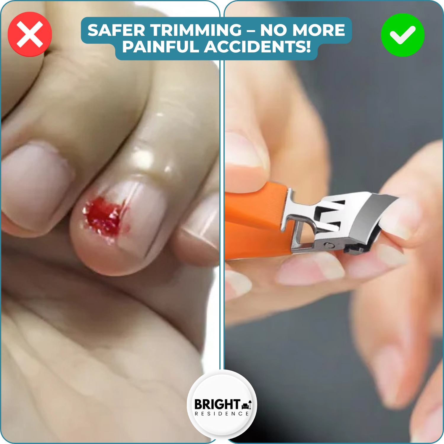 WideTrim™ - Wide-opening, splash-proof, angled nail clippers