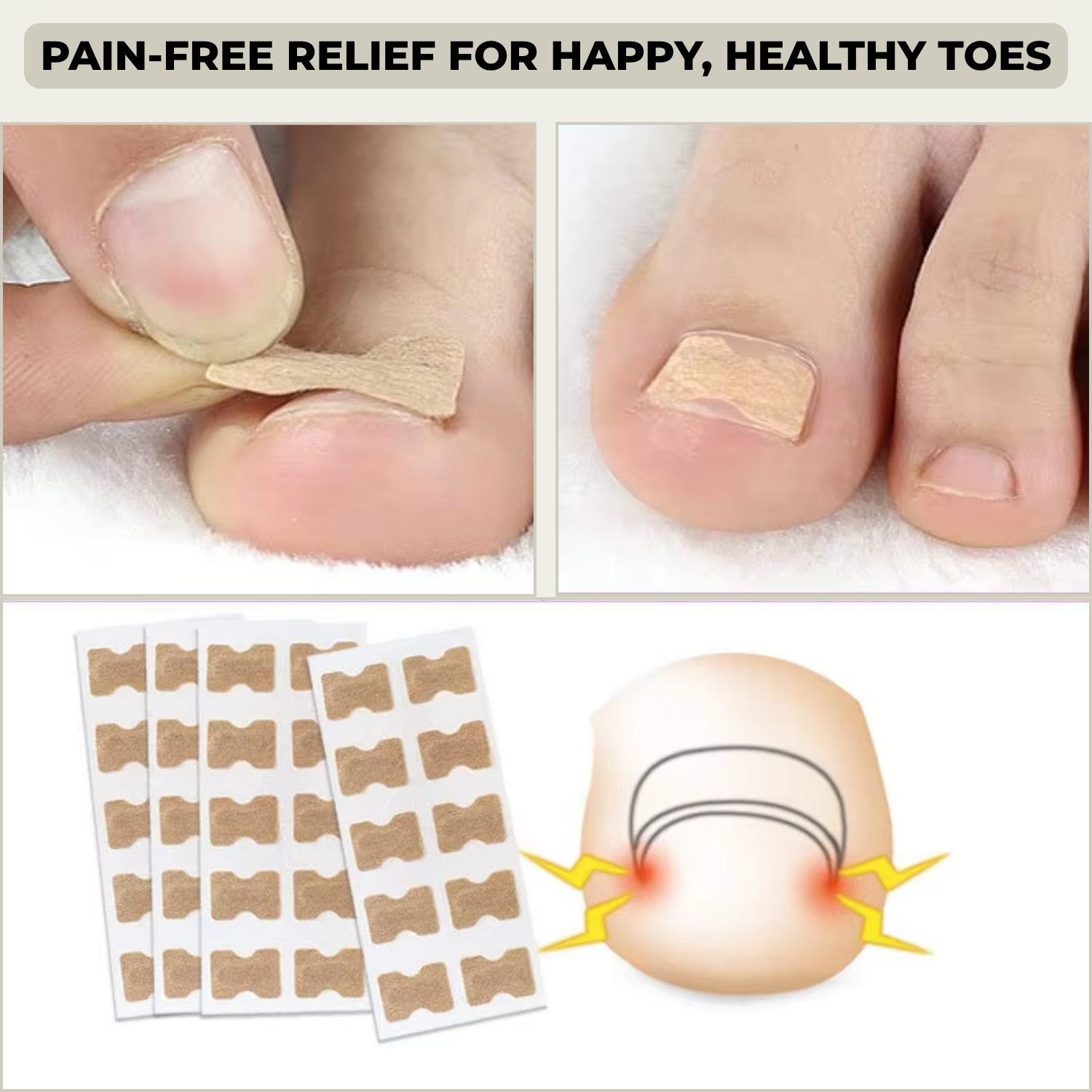 FixaNail™ - Correction Patches for Beautiful and Healthy Nails