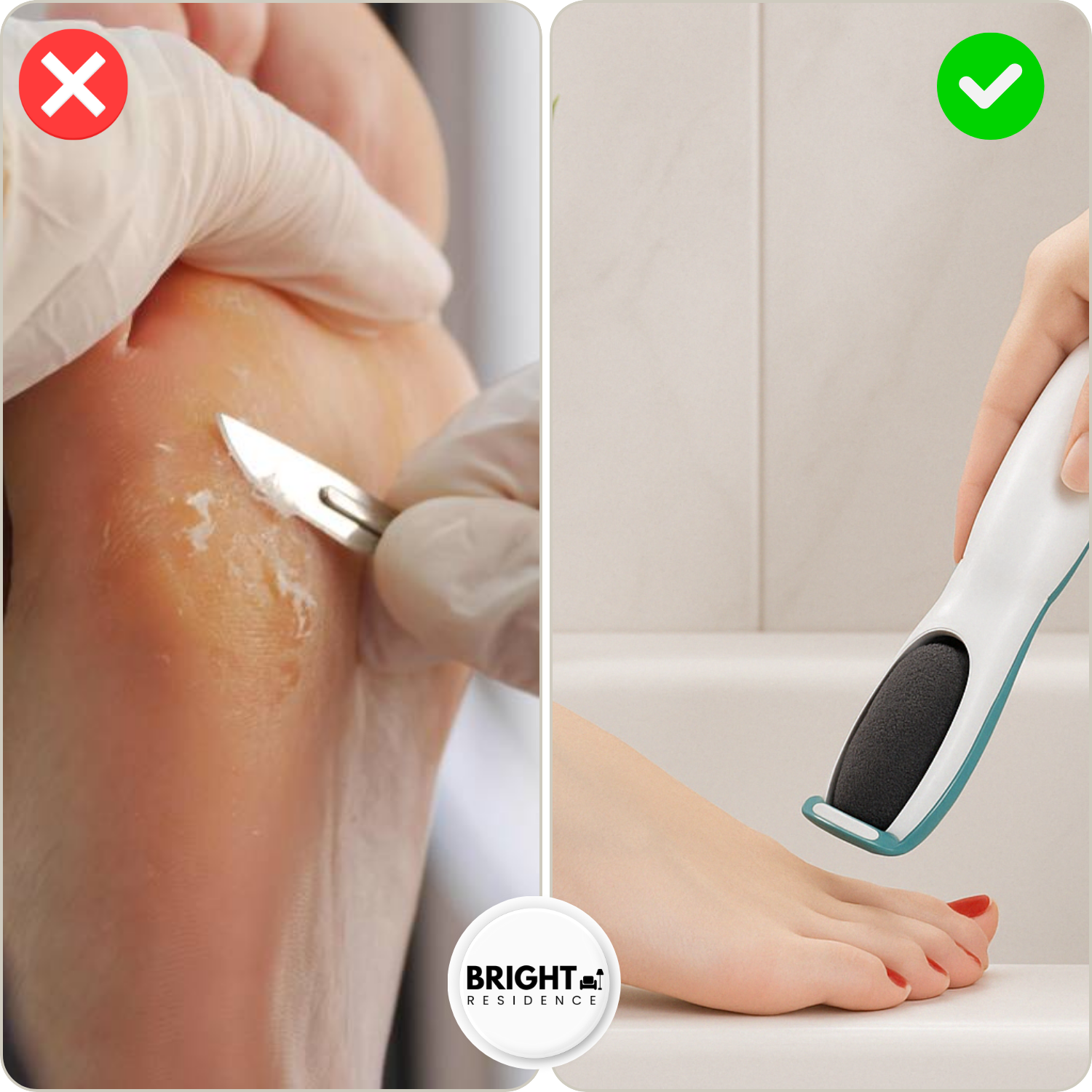 SilkaFeet™ - Effortlessly smooth and well-groomed feet