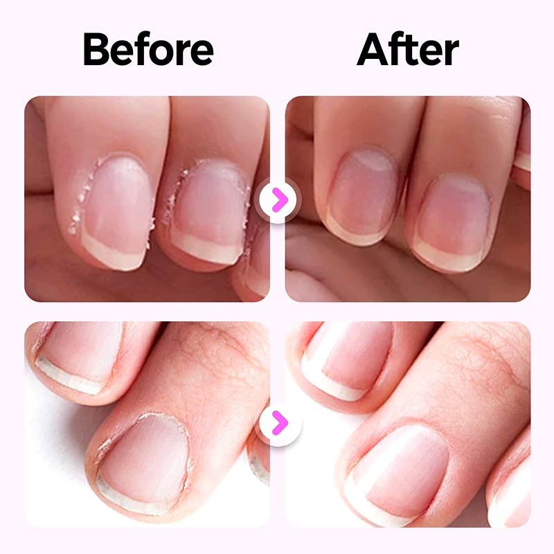 1+1 FREE | MagicNails – Care, Scent & Shine in just 1 Pen