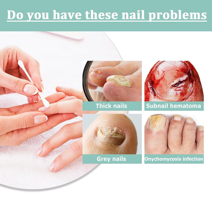 1+1 FREE | NailBloom – Natural Nail Care for Stronger, Healthier Nails