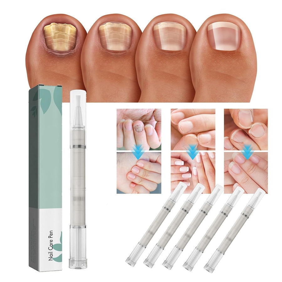 1+1 FREE | NailBloom – Natural Nail Care for Stronger, Healthier Nails
