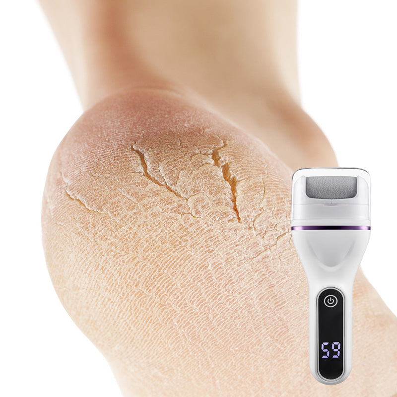 SoftStep Pro – Effortless Foot Care, Anytime, Anywhere